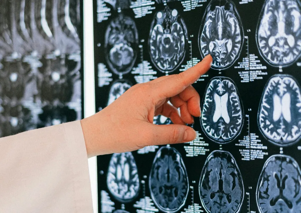 can sleep trackers detect sleep stages