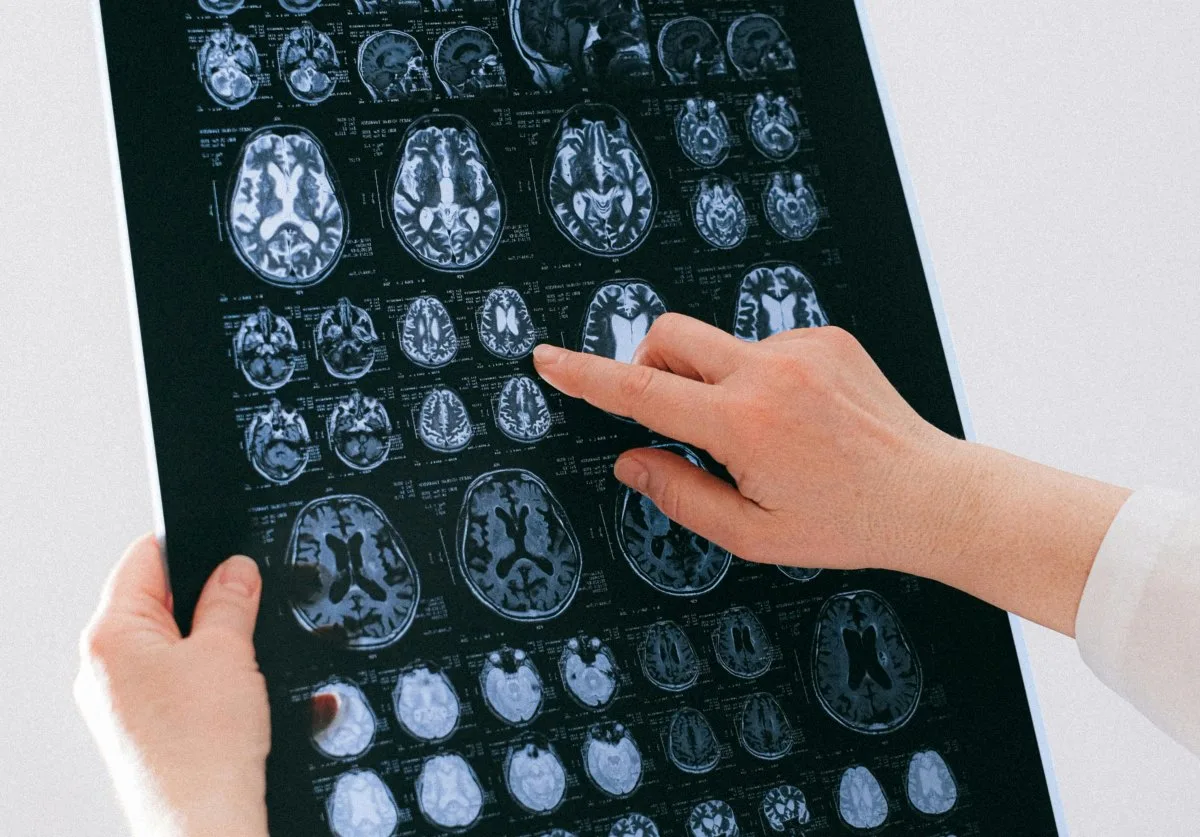 Are Sleep Trackers Accurate? Not in the Way You Think